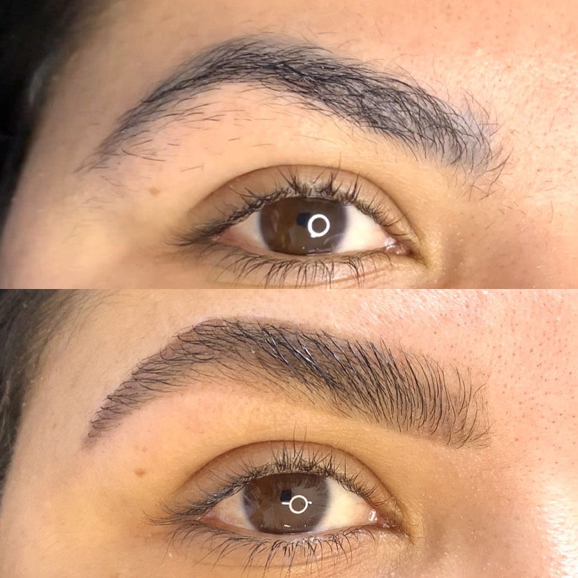 RemoçãoMicropigmentação