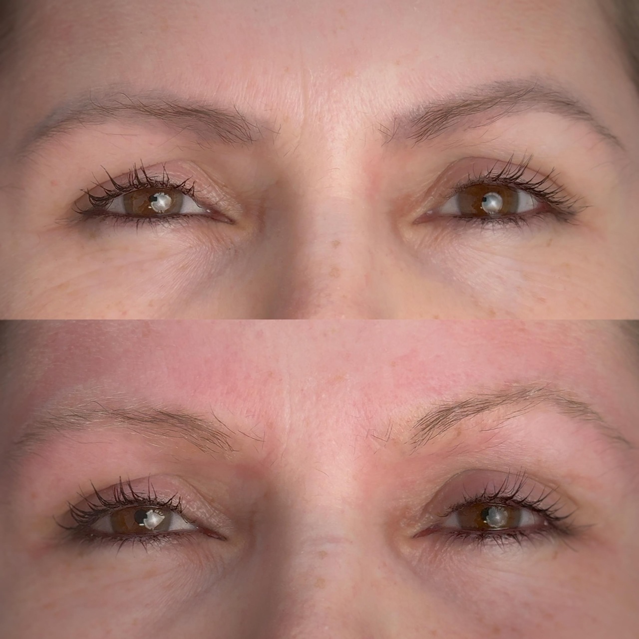 remoção_Easy-Resize.com