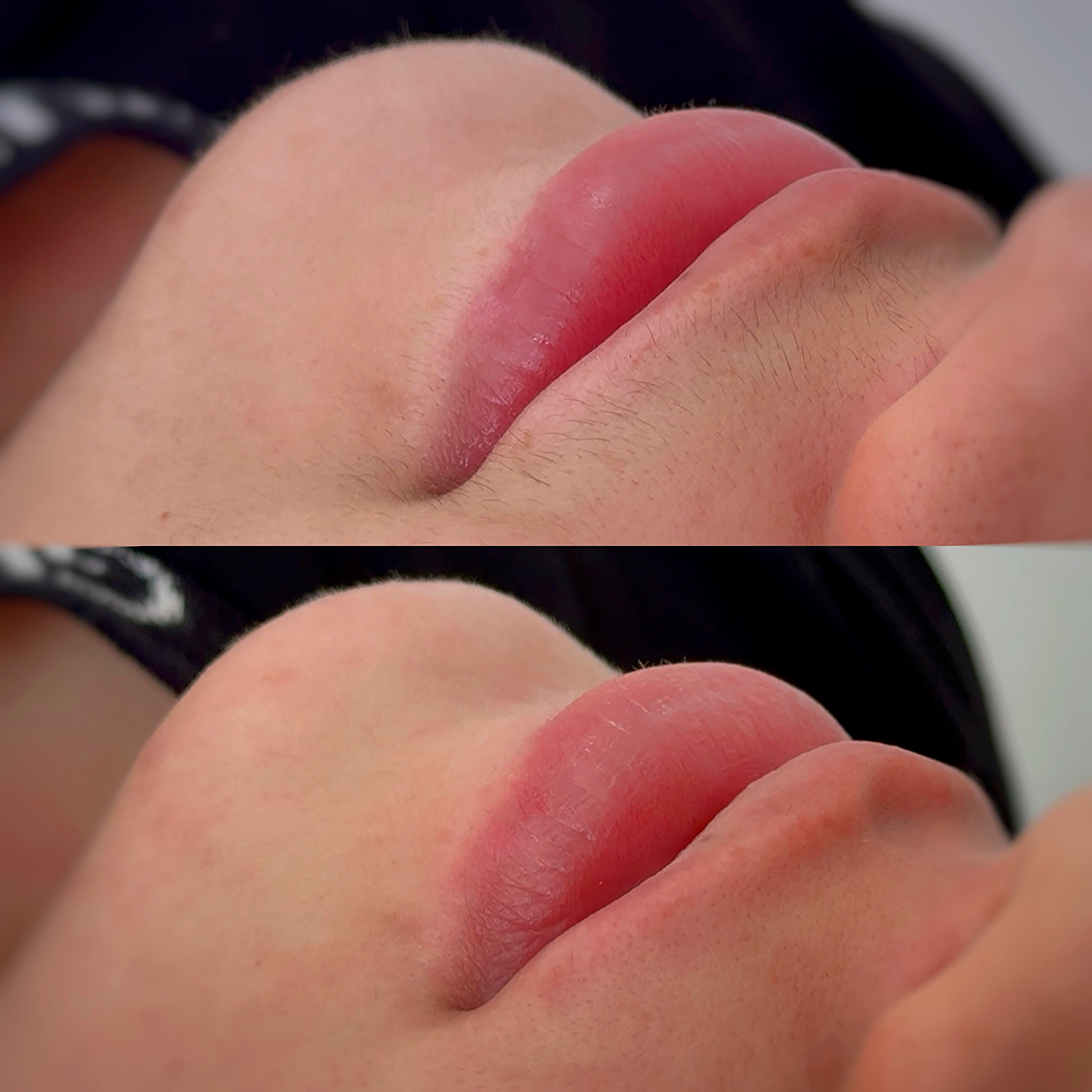 depilação-buço-salto